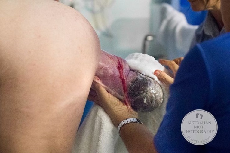 10-fotos-fascinantes-bebes-nasceram-da-bolsa-amniotica-3