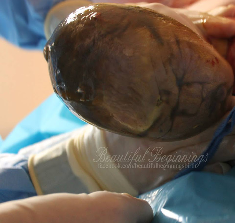 10-fotos-fascinantes-bebes-nasceram-da-bolsa-amniotica-7