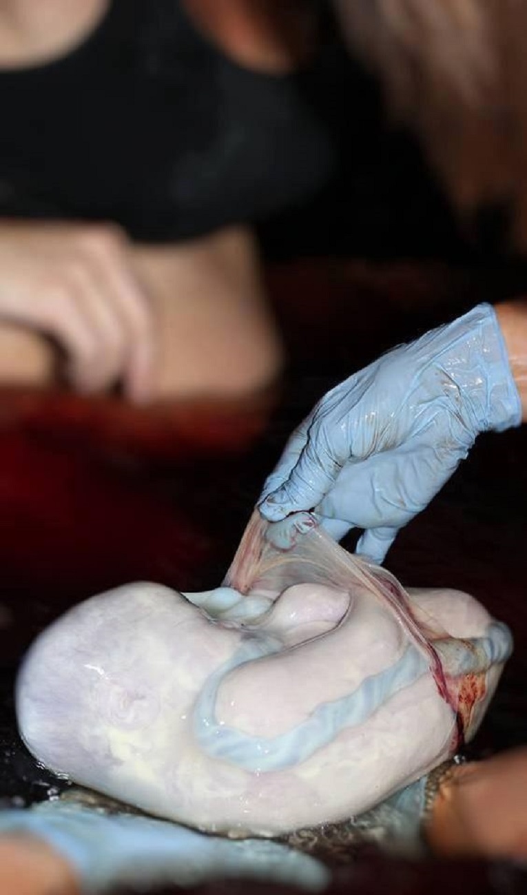 10-fotos-fascinantes-bebes-nasceram-da-bolsa-amniotica-8