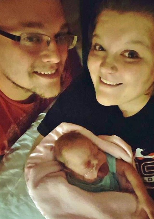 bebe-nasceu-lingua-gigante-ja-consegue-sorrir-2